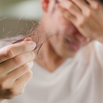 Hair Loss Support